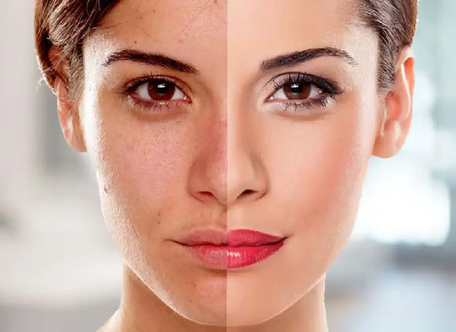 Decapeptide-12 Decapeptide-12