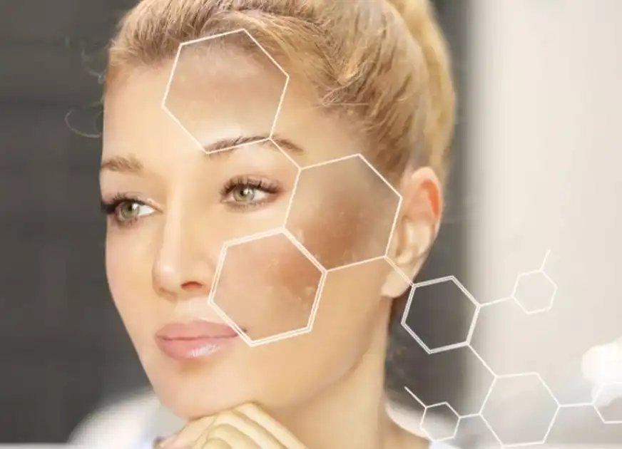 Phenylethyl Resorcinol Phenylethyl Resorcinol