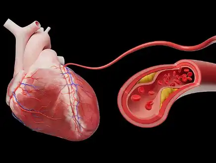 Calcium Phytate Calcium Phytate