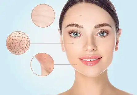 Hydrolyzed Oat Protein Hydrolyzed Oat Protein