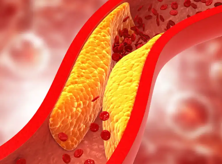 Wild Mango Extract Wild Mango Extract