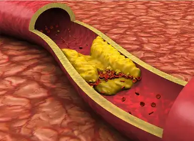 Chitosan powder Chitosan powder