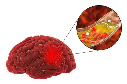 Maitake Polysaccharides Maitake Polysaccharides