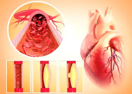 Sophora Japonica Extract Powder Sophora Japonica Extract Powder