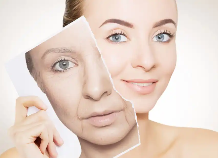 Masson Pine Extract Masson Pine Extract