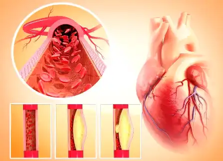 Sweet Orange Flavonoids Sweet Orange Flavonoids