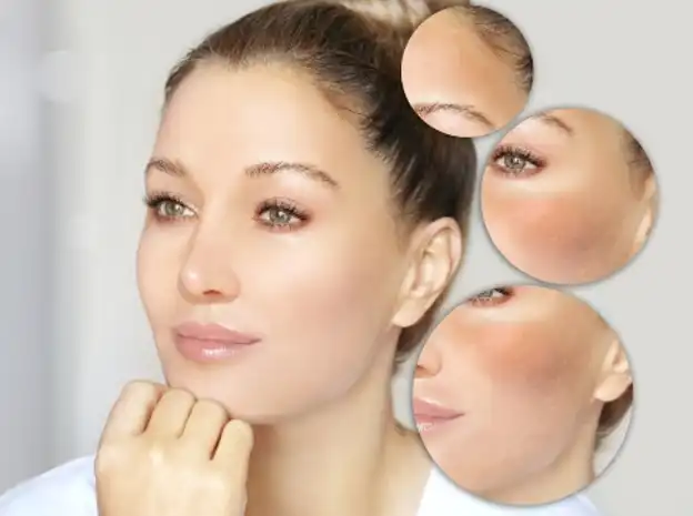 Ceramide NP Powder Ceramide NP Powder