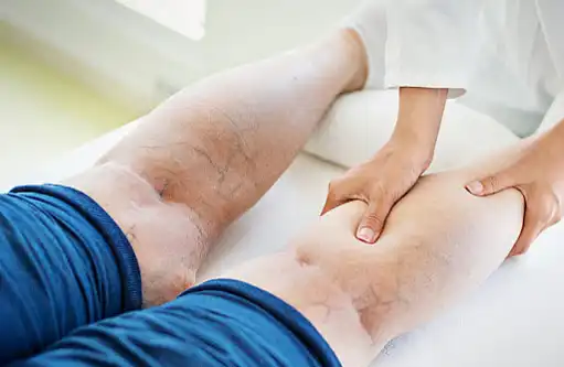 Aescin Powder Aescin Powder