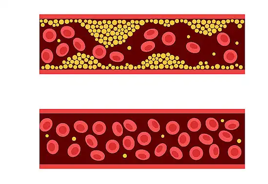 Bulk Ivy Leaf Extract Bulk Ivy Leaf Extract