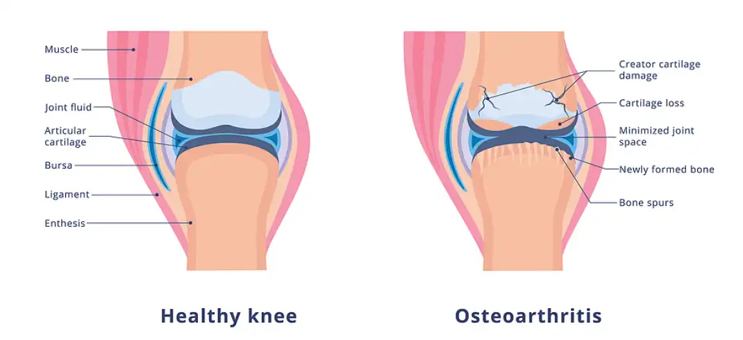 Eggshell Membrane Extract Powder Eggshell Membrane Extract Powder