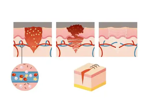 Eggshell Membrane Extract Powder Eggshell Membrane Extract Powder