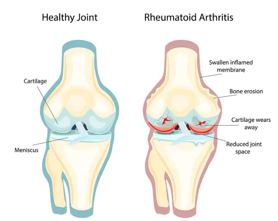 Lemon Grass Extract Oil Lemon Grass Extract Oil
