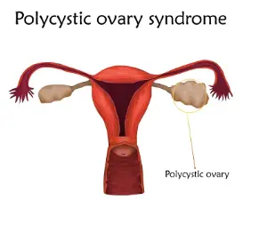 Inositol Powder Bulk Inositol Powder Bulk