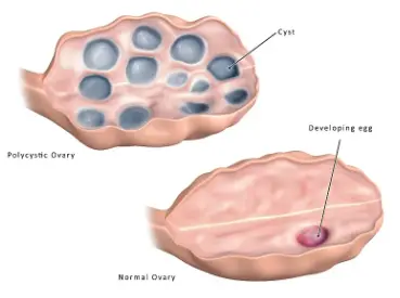 Inositol Powder Bulk Inositol Powder Bulk