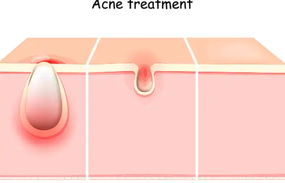 Bulk Centella Asiatica Extract Bulk Centella Asiatica Extract