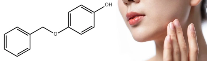 Monobenzone Powder