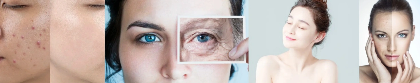 Hydrolyzed Sponge Spicules Hydrolyzed Sponge Spicules