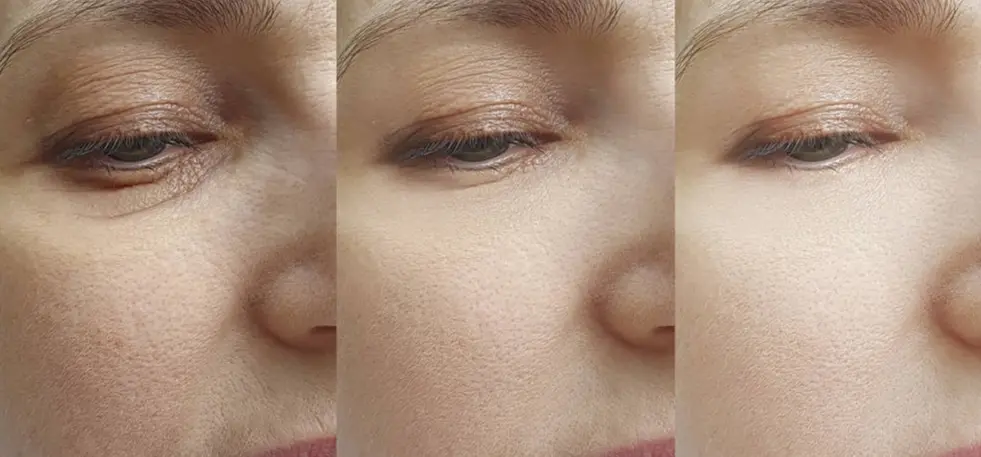 Retinol Powder Bulk Retinol Powder Bulk