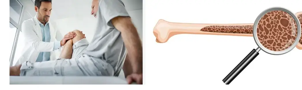 Best Collagen Type II Powder