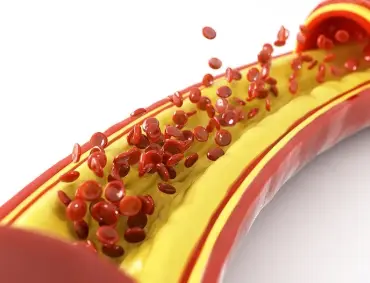 Cardiovascular Health