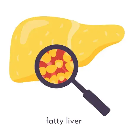 Fatty Liver