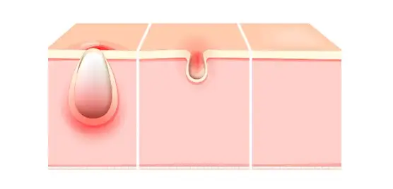 නිෂ්පාදන-556-268 නිෂ්පාදන-556-268