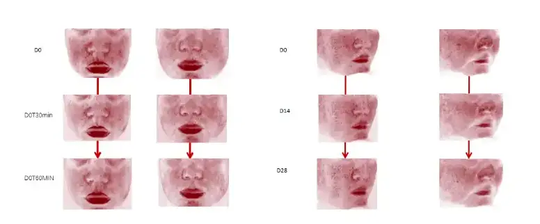 Soothing and Reducing Redness Soothing and Reducing Redness