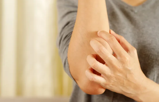The Potential of GHK-Cu in Psoriasis Care: Anti-inflammatory, Repairing, and Antioxidant Mechanisms The Potential of GHK-Cu in Psoriasis Care: Anti-inflammatory, Repairing, and Antioxidant Mechanisms